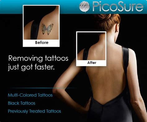 picosure laser tattoo removal near me